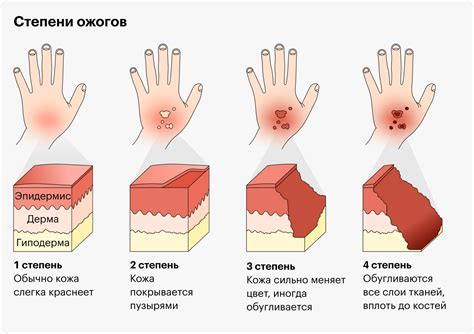 Опасности при наливании через руку