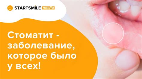 Почему появляется ил