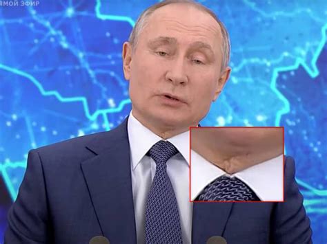 Предположения о происхождении и значении шрама актера