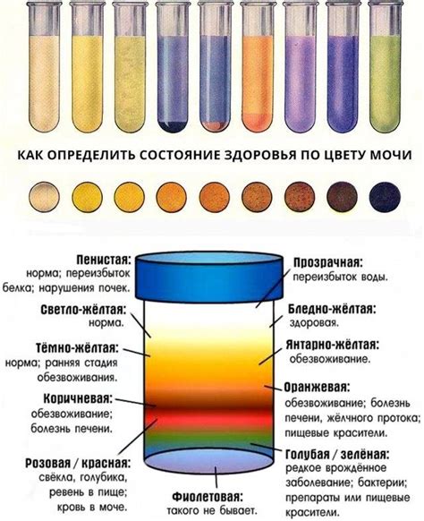 Причины изменения цвета мочи