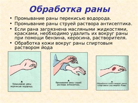 Промывание раны