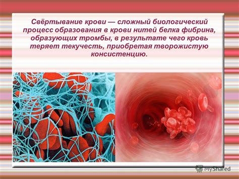 Процесс образования и хранения крови в селезенке