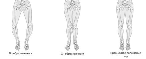 Адаптация домашней среды для изменения длины ноги у ребенка