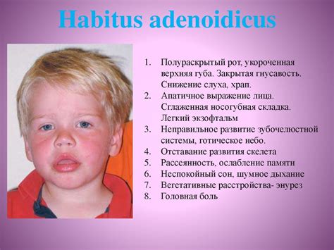Влияние аденоидов на речь ребенка