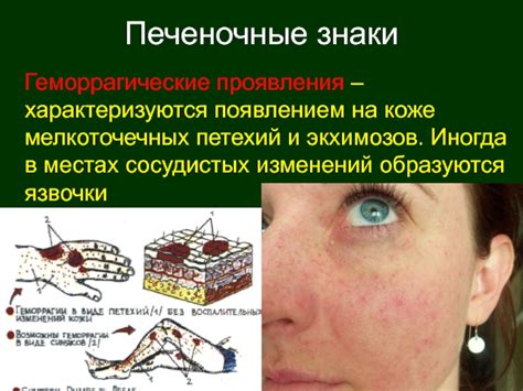Вредные последствия петехий на коже