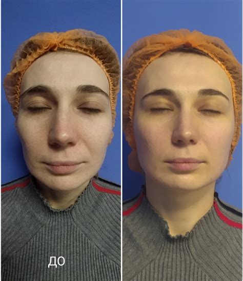 Выбор специальных массажных техник