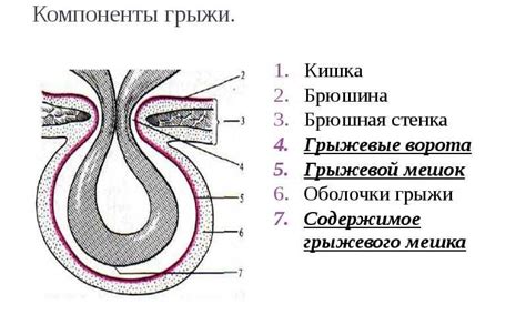 Последствия неудаленной пупочной грыжи
