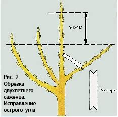 Послеобрезковый уход