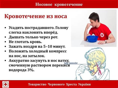 Способы остановки кровотечения из носа