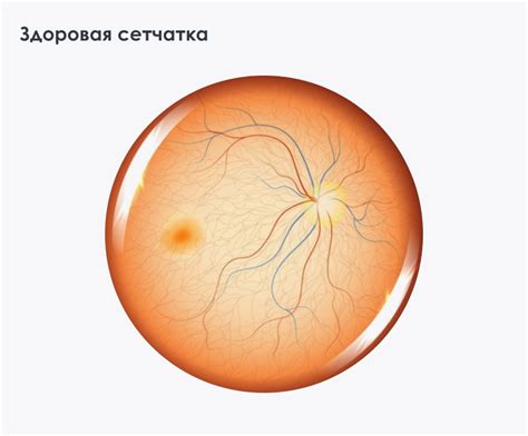 Успешное лечение катаракты при дистрофии сетчатки